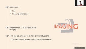 Adrenal Incidentaloma and Mild Autonomous Cortisol Secretion: Evaluation and Management