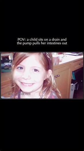 deadhost.exe on Instagram: "On June 29, 2007, 6-year-old Abigail Taylor was playing in a public wading pool in Edina, Minnesota. She sat over an open drain hole where the cover had come loose. The pool’s powerful filtration pump created a vacuum seal against her body, generating incredible suction force known as Delta P. The suction was so intense that it didn’t just trap her; it physically eviscerated her. The force pulled 21 feet of her small intestine out within seconds. Horrifically, she man