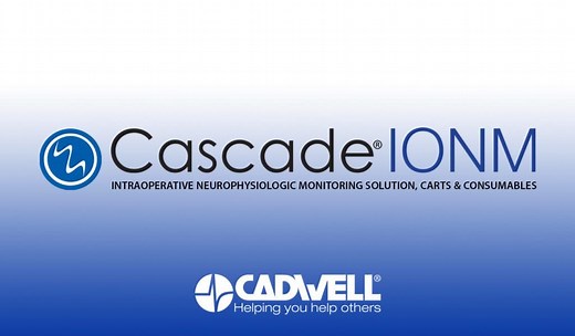 Intraoperative Neuromonitoring IONM IOM NIOM | Cadwell Industries, Inc.