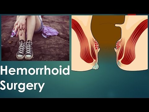 What is a Hemorrhoid? What Is The Cause of Hemorrhoids? Hemorrhoid Surgery Risk and Complication