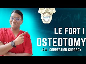 Dr Rudra Mohan |Transforming Smiles:The Amazing Le Fort 1 Osteotomy Procedure Explained| Jaw Surgery