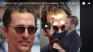MATTHEW MCCONAUGHEY HAIR TRANSPLANT - THE REAL TRUTH!