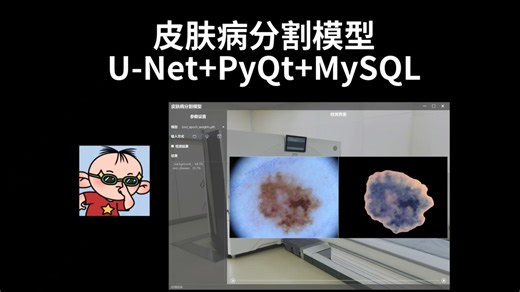 皮肤病分割模型，UNet PyQt MySQL