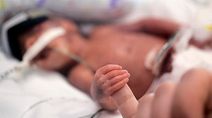 Born too soon: Journalist parents explore medical frontier of micro-preemies | CBC Radio