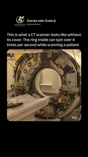 Inside a CT Scanner Without Its Cover 🤯 Medical Tech Explained