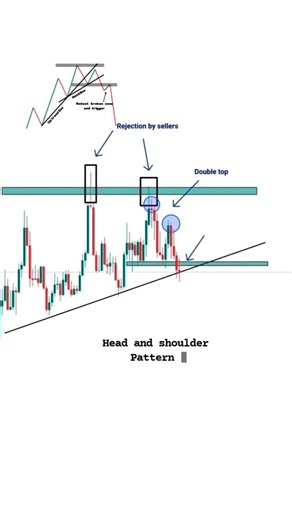 Head & Shoulder Chart 📈 Pattern | #trading #chartpatterns #intraday #trending