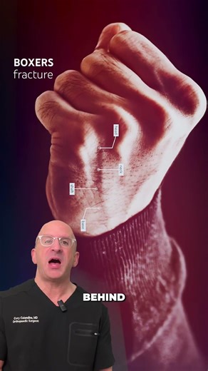 The Ulnar Gutter Splint Most People Do Wrong #shorts #healthcare #technique