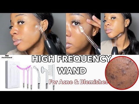 HOW TO USE HIGH FREQUENCY WANDS TO TARGET ACNE AND BLEMISH PRONE SKIN | ProfacialWand