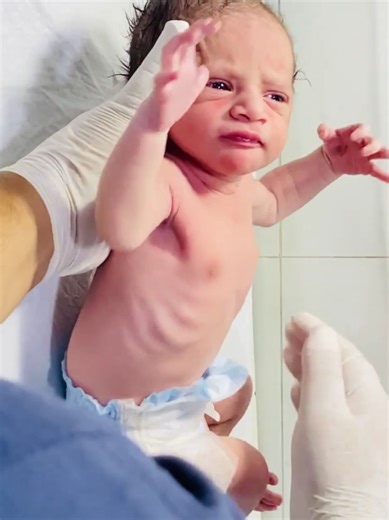 Captivating Moments: Newborn's First Breath