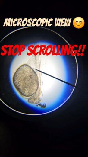 Developing angelfish in egg under microscopic view