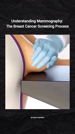 Medical explainer on Instagram: "Mammography is a specialized X-ray technique that uses low-energy X-rays to create images of the inside of the breast tissue (called a mammogram). Main Goal: The goal is the early detection of breast cancer, often years before it can be felt as a lump or cause other symptoms. Early detection significantly improves treatment outcomes. Procedure: The breast is briefly compressed between two plates on the X-ray machine. This spreading of the tissue is necessary to g