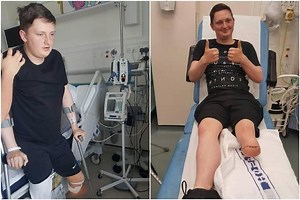 Scots archery ace to walk for first time in two years after leg amputation