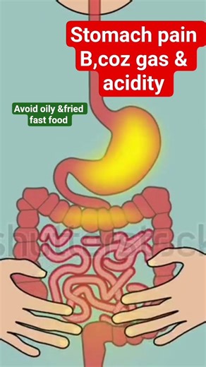 fast food then making gas and acidity #medical #medicine #meditation #ytshorts #ytshort #yt #ytshort