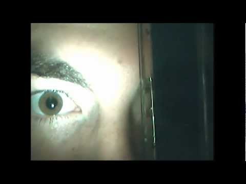 Relative Afferent Pupillary Defect - Indiana University