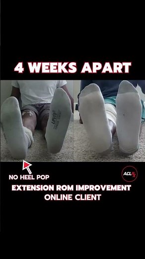 ACL - Knee Extension Range of Motion