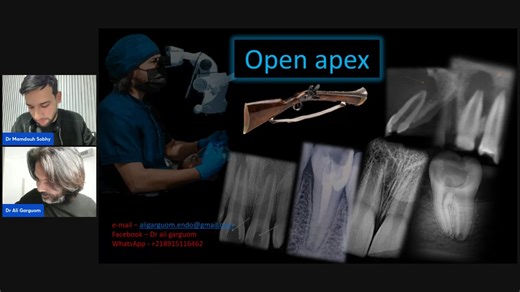 Dr Ali Gargoum - Open Apex management The lecture is sponsored by: Epona EG DENT ToothMate | Style Arabiano