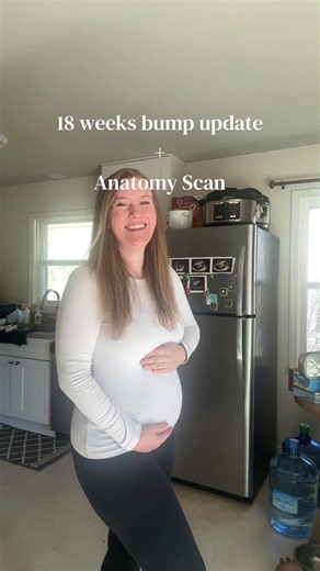 Anatomy Scan Update at 18 Weeks Pregnant