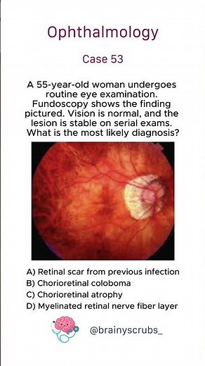 Ophthalmology - Case 53