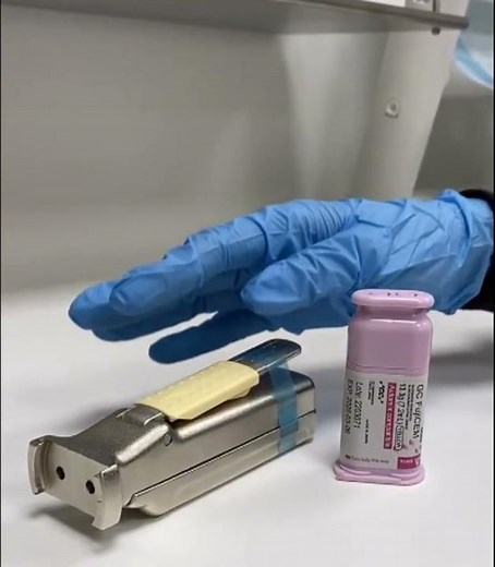 🦷 Tipos de Ionómeros de Vidrio: Cementantes, Restauradores y Base Cavitaria