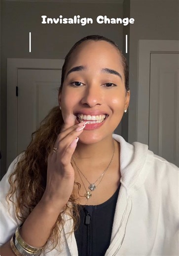 Invisalign Tray Change Explained