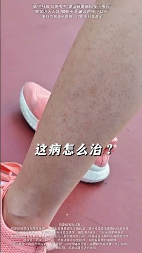 6种常见皮肤病，一个视频教你怎么治！#单纯疱疹 #汗疱疹 #神经性皮炎 #火疖子 #医学科普