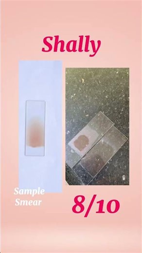 Rating My Colleagues Thin Blood Film #laboratory