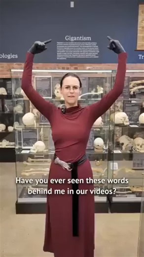 BRUH 乇乂ㄒ尺卂 ㄒ卄丨匚匚 on Instagram: "(The Bone Museum) Learn about gigantism."