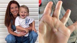 Aussie speaks out about cancer diagnosis