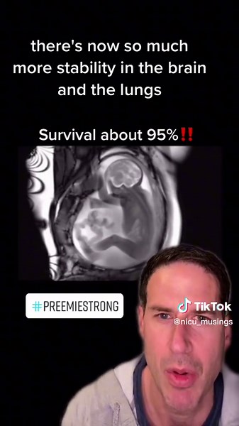 What to Expect at 29 Weeks Pregnant | Baby Development Milestones