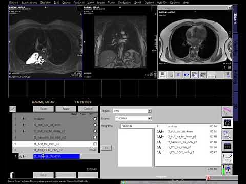 Mediastinum / Chest MRI Routine ( thoracic mass)