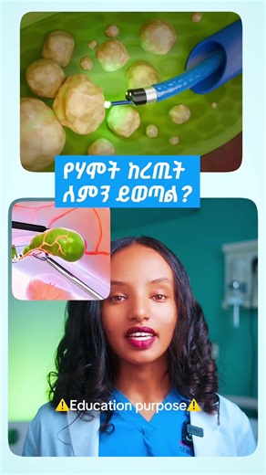 Understanding Gallbladder Removal in Gallstone Treatment