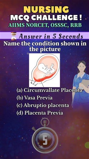 🧠NURSING MCQ CHALLENGE | Answer in 5 Seconds!⏳#bscnursing #aiims #mcqs #exampreparation #norcet