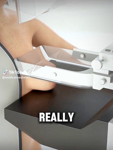 Mammography: Early Breast Cancer Detection Explained