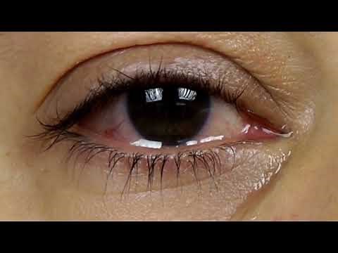 Crying Woman Eye With Tears Hd | By Creator Stockify