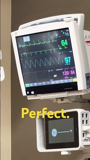 Heart Monitor Close-Up | Real-Time Heartbeat & Blood Pressure Reading