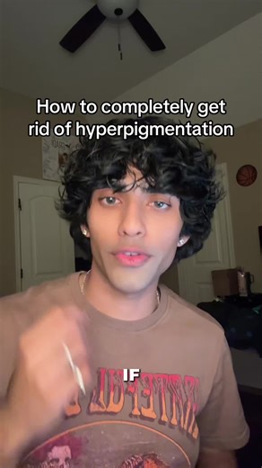 How to fix your hyperpigmentation #skincare #looks | hyperpigmentation on face