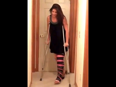 Alexandra broken leg, LLC and crutches Full video at Brokenangelx com