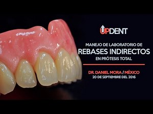 Manejo de laboratorio de rebases indirectos en protesis total