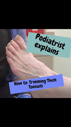 Cutting thick toenails can be hard. Our quick tutorial on how to cut them! #toenails #toenailfungus #podiatrist