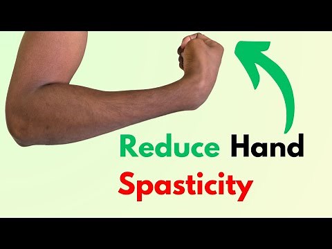 Fix Arm Spasticity & Tightness: Stroke Recovery