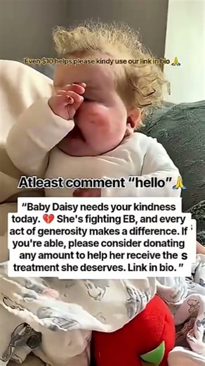 Every second counts. Please help Baby Daisy battle EB. A $20 or $50 donation helps move #shortvideo