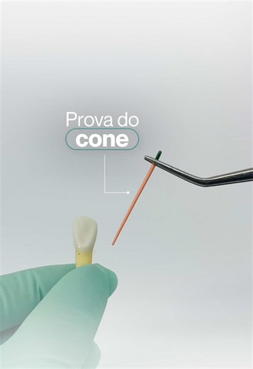 A prova do cone é uma etapa crucial na endodontia! É essa etapa que garante se o cone está realmente adaptado ao canal antes da obturação. ✔ Avaliação tátil ✔ Confirmação radiográfica ✔ Ajustes quando necessário Gostou desse conteúdo? Não esquece de salvar para revisar🩵 #endodontia #odontolover #odontoporamor #dentista #dicasodonto