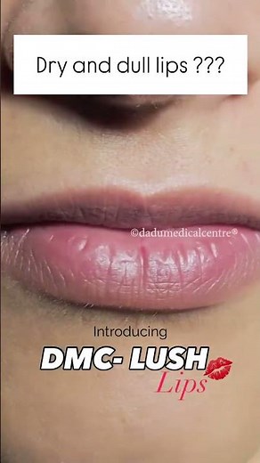 DMC Lush Lips: Fix Pigmented, Dry Lips Without Fillers or Downtime! 💋✨