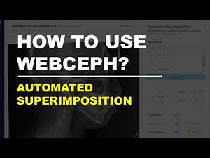 How to use WEBCEPH: Automated Superimposition