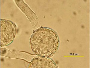 Pollen Germination in vitro