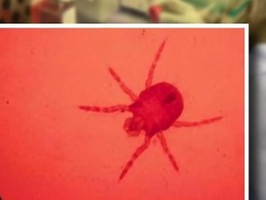 Raleigh residents are dealing with tiny, red bugs that leave horrendously itchy bites