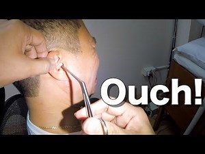 Something Stuck in Man's Ear For Days Finally Removed