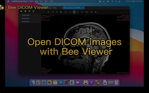Mac上非常好用的DICOM Viewer软件
