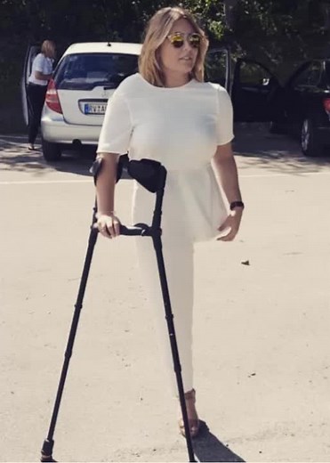 Amputee girl a serious and painful accident led to the amputation of my leg #amputeegirlstumps