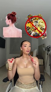Acné | Hormonal Glands